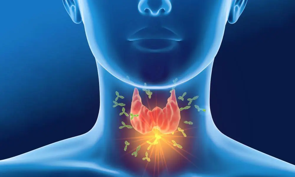 Hypothyroidism